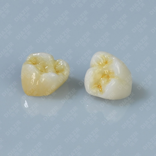 ST Special for posterior teeth and long bridge/ST后牙及长桥专用