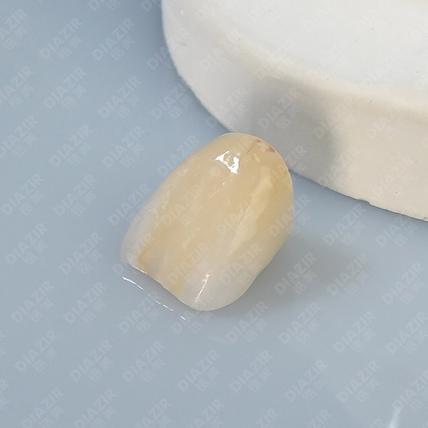 SST Special for anterior teeth and single crown